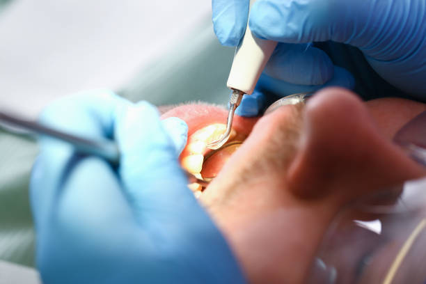 Best Emergency Broken Tooth Repair in Killian, LA